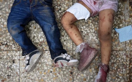 近东救济工程处主任：以色列将加沙变成‘儿童和饥民的坟场’