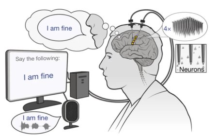 脑机接口，让失声者“重新开口”
