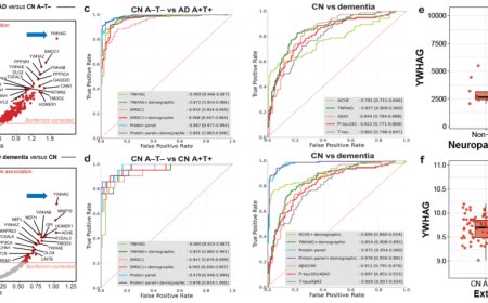 复旦大学研发新型早筛早诊检测试剂，突破性提前 15 年预测阿尔茨海默病发病风险