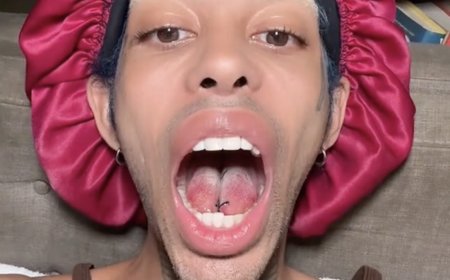 TikTok Star Shares Before and After Videos of Tongue-Splitting Surgery