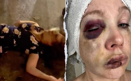 Cincinnati beatdown victim reveals 'very bad brain trauma' in first remarks since viral assault