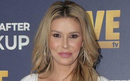Brandi Glanville Suffers Severe Chemical Burns After Attempting To Remove Facial Parasite With Nair