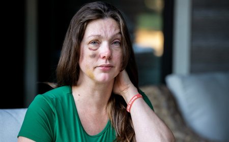 Cincinnati viral beating victim says violent mob started attacking 'like a pack of wolves'