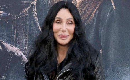 Cher Reportedly Sparks Plastic Surgery Concerns As 'It's Really Catching Up To Her'