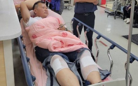 惡犬攻擊運動阿北！議員救人「2腿狂噴血」　牛仔褲被咬爛畫面曝