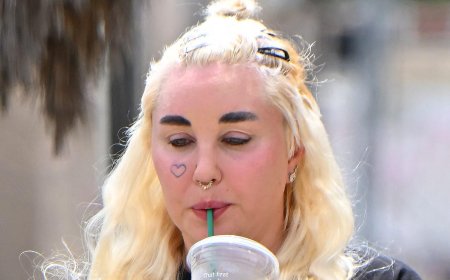 Amanda Bynes Flaunts Her Fresh Lip Injections In New Video After Her Ozempic Confession