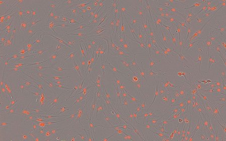 NASA 与 SpaceX 合作任务将赴空间站，欲破解太空骨质流失之谜