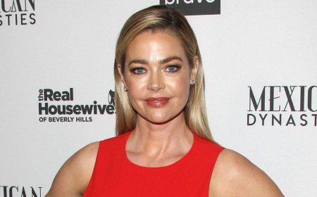 Denise Richards Opts For Another Surgery To 'Feel Like Myself Again' Amid Divorce Drama