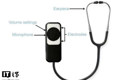 用了 200 年的听诊器装上“AI 大脑”：可在 15 秒内识别三种心脏疾病