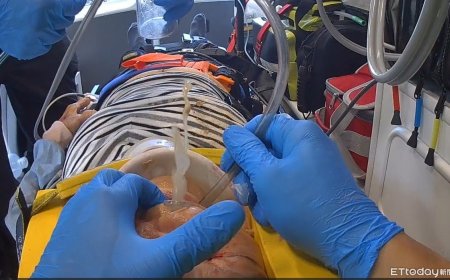 鐵工廠工人突昏厥倒地　屏東首支高級救護隊鬼門關前搶命