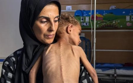 新的饥荒受害者与联合国报告员警告加沙饥荒蔓延