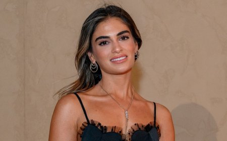 My Unorthodox Life’s Batsheva Shares 'Full Breakdown' of Her Plastic Surgery