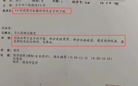 小米 13 手机突发爆炸致 3 岁男童受伤，客服回应需专业检测确定自燃原因