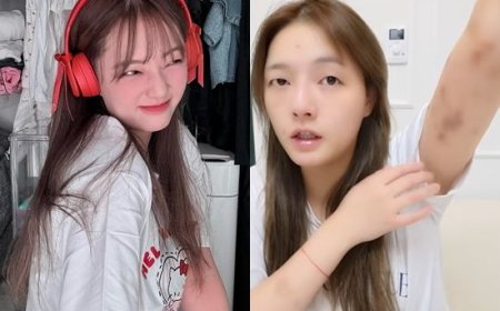 正妹YTR遭韓男暴打首露面！狼狽全身傷現狀曝光　公開當晚完整對話