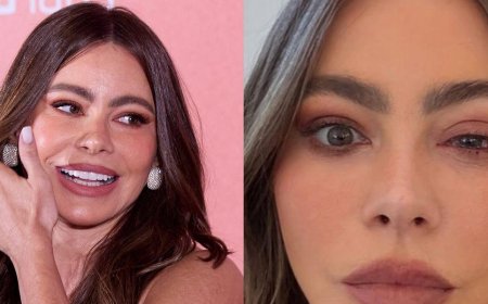 Sofia Vergara Missed Out on the 2025 Emmys Due to ER Visit for 'Craziest' Allergy That 'Looks Painful'