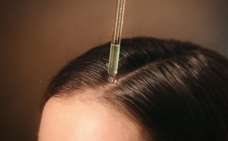 用錯等於白擦！養髮頭皮精華4個重點必看　這樣才有效