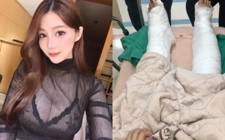 女網紅台東搭船遭「捲入螺旋槳」！美腿重傷留疤　船長挨告結果曝