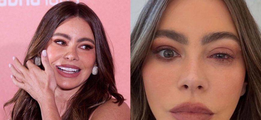 Sofia Vergara Missed Out on the 2025 Emmys Due to ER Visit for 'Craziest' Allergy That 'Looks Painful'