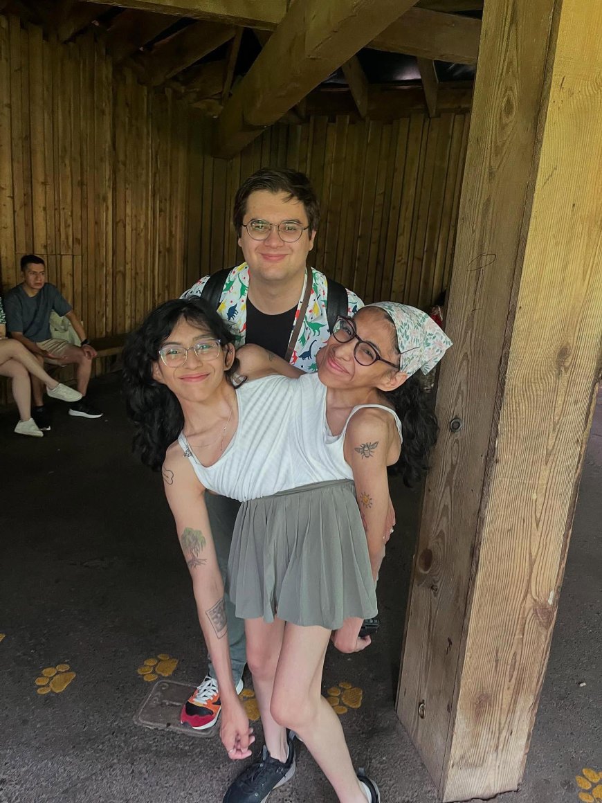Conjoined Twins Carmen and Lupita Andrade Reveal How They Navigate Intimacy