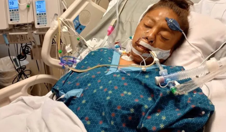 女被比特犬拖下單車狠咬「痛失雙臂雙腿」　男友當場擊斃惡犬