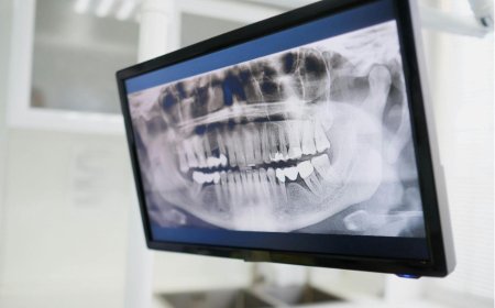 缺牙可能加深法令紋？拔牙後如何避免齒槽骨流失？補骨粉是必要的嗎？