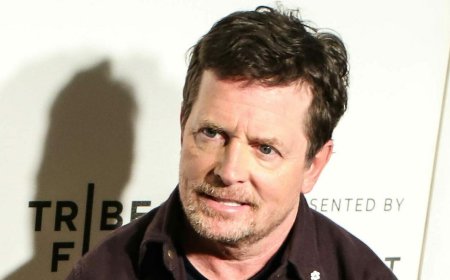 Michael J. Fox Wants Back In The Acting Game Amid Parkinson's Battle