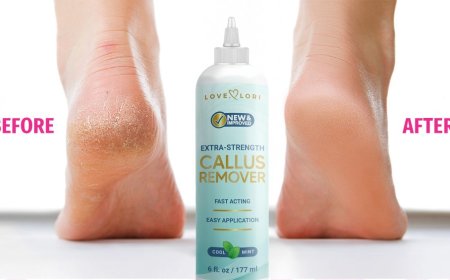 This Salon-Quality Callus Remover Dissolves Thick Dead Skin — On Sale for $9