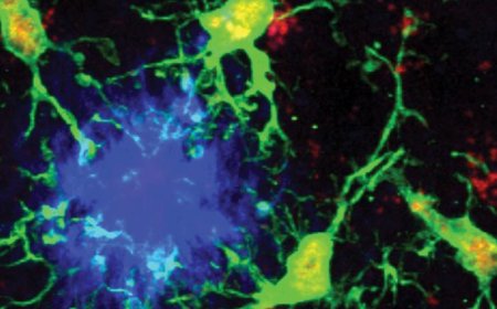 重磅：科学家找到阿尔茨海默病的“内置刹车系统”