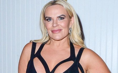 'RHOSLC' Star Heather Gay Raves About 6-Figure Plastic Surgeries