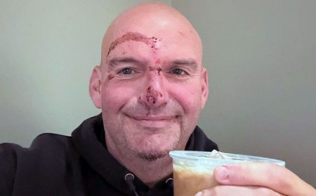 Sen. Fetterman shares graphic photo after heart rhythm scare, says doctors ‘put me back together’