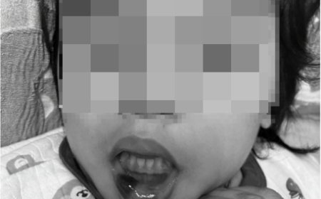 超扯！台東特教師狠虐6幼童「全身是瘀青」　校長調職加給照領