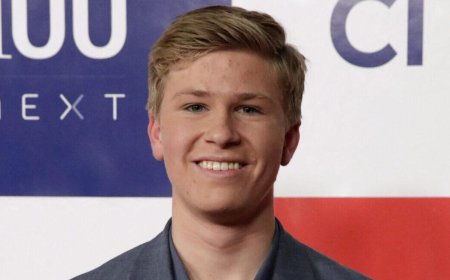 Robert Irwin Is Reportedly Nursing An Injury Ahead Of 'DWTS' Finale