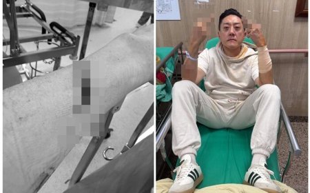 「夜店大亨」夏天倫遭砍濺血　深夜發文曝心聲：替朋友擋一刀