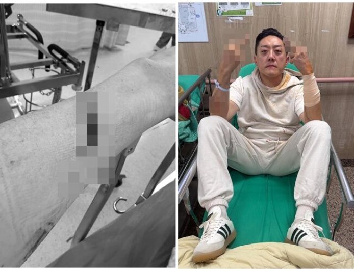 「夜店大亨」夏天倫遭砍濺血　深夜發文曝心聲：替朋友擋一刀