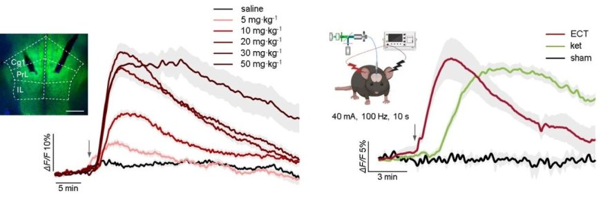 北京脑科学与类脑研究所：发现抑郁症治疗新机制，有望颠覆传统治疗手段