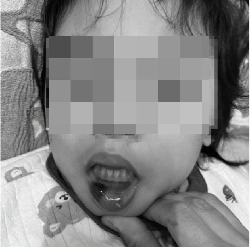 超扯！台東特教師狠虐6幼童「全身是瘀青」　校長調職加給照領