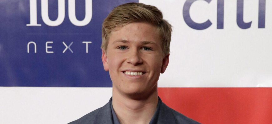 Robert Irwin Is Reportedly Nursing An Injury Ahead Of 'DWTS' Finale