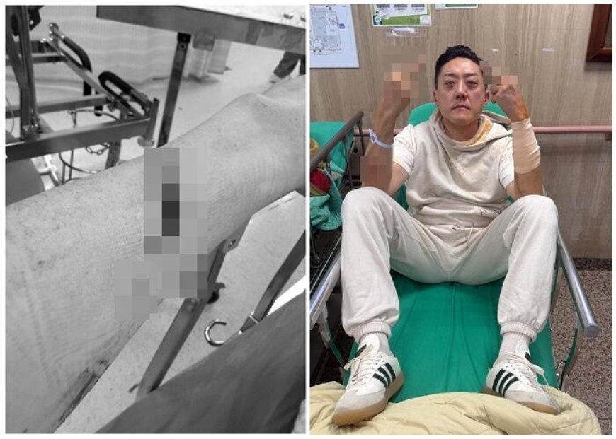 「夜店大亨」夏天倫遭砍濺血　深夜發文曝心聲：替朋友擋一刀