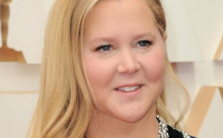 Amy Schumer's Facial Transformation Raises Eyebrows As Expert Weighs In On Possible Cosmetic Enhancements