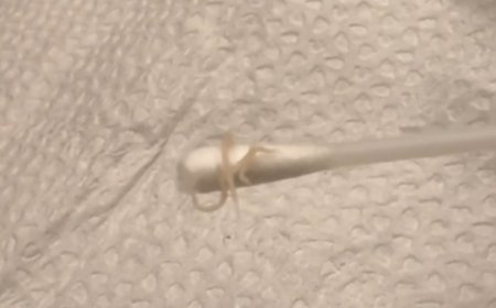 正妹媽驚見女兒屁股「爬出蟯蟲」　半夜掏出3、4隻嚇爛