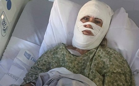 Georgia woman hospitalized after attacker hurls corrosive chemical during evening walk