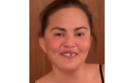 Chrissy Teigen Knocks Out Her Own Front Tooth in Candy Cane Mishap