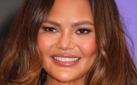 Chrissy Teigen Suffers Chipped Tooth After Candy Cane Game Goes Wrong