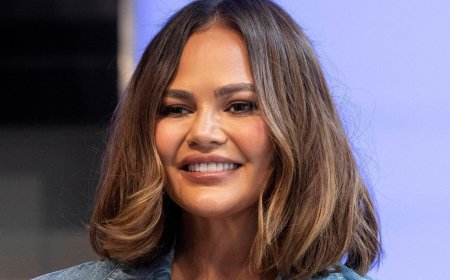 Chrissy Teigen Gets Her Smile Back For Christmas After Candy Cane Tooth Mishap