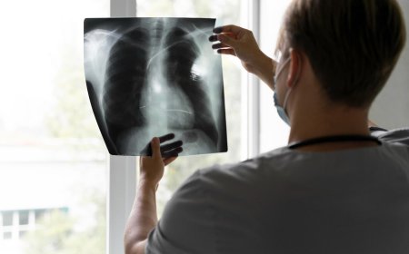 肺癌連3年奪十大癌症之冠、大腸癌緊追在後　112年國人罹癌突破13.8萬人