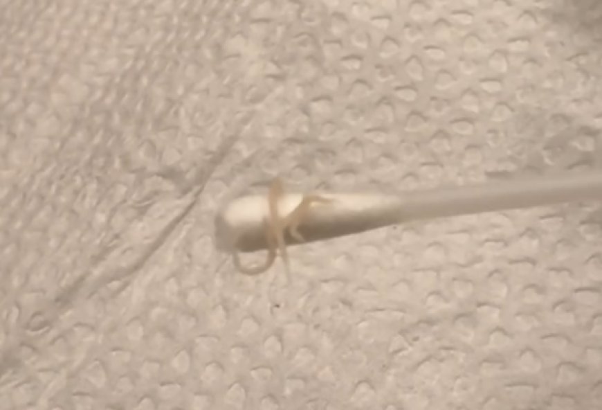 正妹媽驚見女兒屁股「爬出蟯蟲」　半夜掏出3、4隻嚇爛