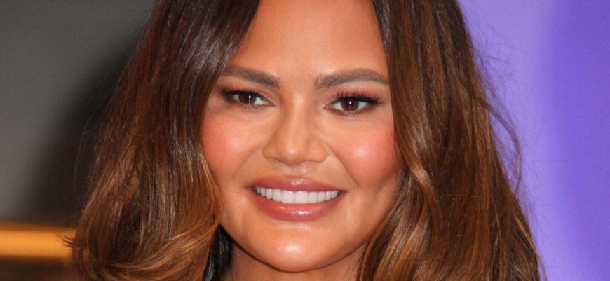 Chrissy Teigen Suffers Chipped Tooth After Candy Cane Game Goes Wrong