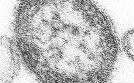 全美去年累计报告麻疹病例已达2012例 创30年来新高