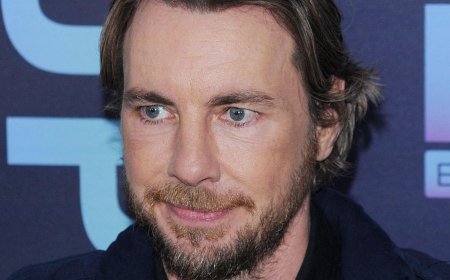Dax Shepard Breaks Silence On 'Jaw Implant' Rumors With Telling Confession