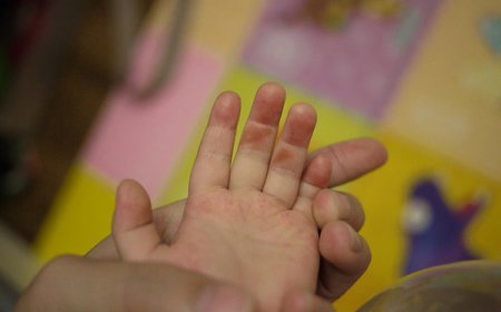 保母餵1歲半幼兒吃起司饅頭！塞「5碎塊」缺氧過久...搶救45天亡